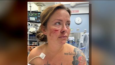 WOMAN ATTACKED BY MAN WITH KNIFE AT NEWARK AIRPORT