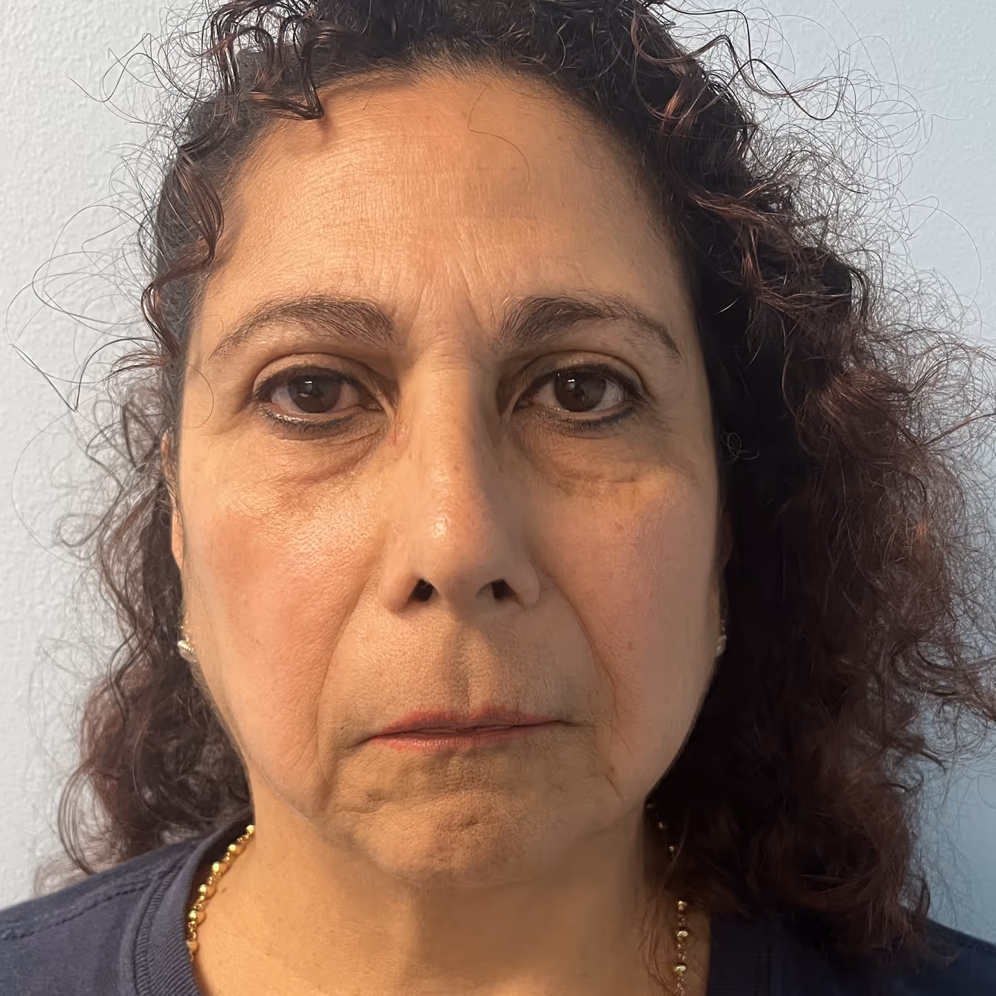 5-Year-Old Seriously Injured in Fair Lawn Hit-And-Run; Driver Arrested